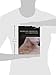 Cranio-Cervical Syndrome: Mechanisms, Assessment and Treatment