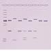 Edvotek 311 DNA Fingerprinting Southern Blot Analysis Using Non-Isotopic Detection of DNA, For 5 Groups
