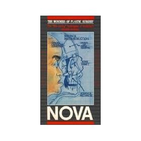 Nova: Plastic Surgery [VHS]