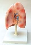 Copernicus - Human Lung Model