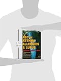 ABC of Asthma, Allergies and Lupus: Eradicate Asthma - Now!