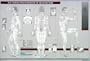 Points & Meridians of Acupuncture Chart