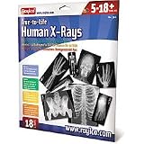 Human X-Rays on Film