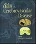 Atlas of Cerebrovascular Disease, 2e (Current Medicine title)