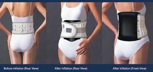 Air Pocket Expansion System: Lso Expander Orthosis - 5X