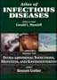 Atlas of Infectious Diseases Volume 7: Intra-abdominal Infections, Hepatitis and Gastroenteritis, 1e