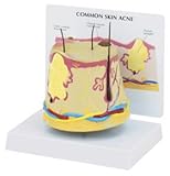 GPI Anatomical Skin Acne Model GPI Anatomical Skin Acne Model