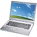Maxdata Notebook ECO 4700 IW Select