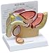 Male Pelvis cross-section including a testicle with cancer