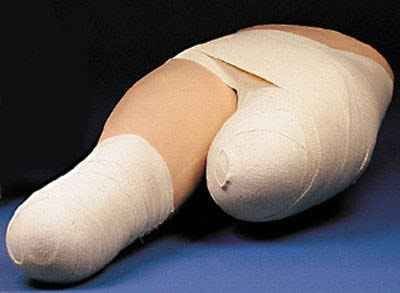 Nasco Lower Stump Bandaging Simulator