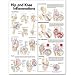 Hip and Knee Inflammations Anatomical Chart 2nd Edition, Unmounted