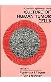Cultural of Human Tumor Cells and Cultural of Epithelial Cells (Culture of Specialized Cells)