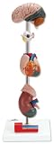 3B Scientific Hypertension Model