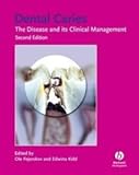Dental caries : the disease and its clinical management