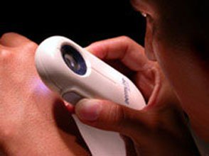 HealthPersonalCare: Dermlite Oil Free Pocket Epiluminescence Microscopy