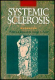systemic sclerosis