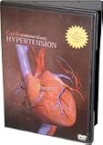 Cardioconnection: Hypertension