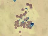 Anopholes Mosquito Oocytes Photographic Poster Print, 32x24