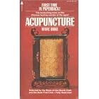Acupuncture by  Marc Duke