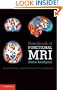 Handbook of Functional MRI Data Analysis