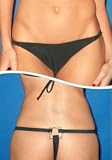 Coconut Grove Thong Bottom