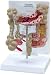 Colon Anatomy Model w/ common pathologies