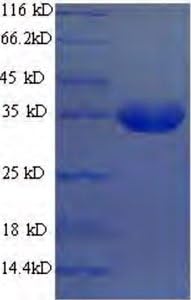 Recombinant Ba(E.coli-k12) Ribokinase, 0.5 mg