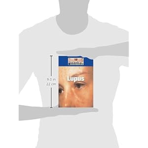 Lupus (Diseases and Disorders)