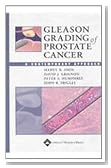 Gleason Grading of Prostate Cancer: A Contemporary Approach