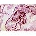 Drosophila chromosome sq.