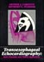 Transesophageal Echocardiography: Basic Principles and Clinical Applications