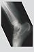 Ankle by Unknown. Size 11.13 inches width by 15.72 inches height. High Quality Art Poster Print
