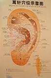 Acupuncture Ear Chart