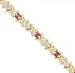Ruby & Diamond Bracelet - Hugs and Kisses in 14K Yellow Gold