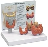 Human Thyroid Diseases Anatomy Model wiith Patient Education Card