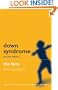 Down Syndrome: the Facts