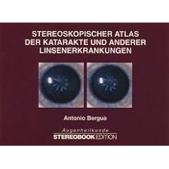 Stereoskopischer Atlas der Katarakte und anderer Linsenerkrankungen