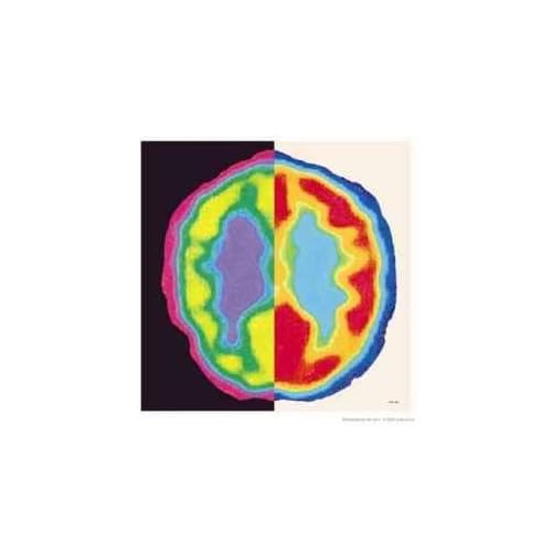 Brain Scan Artwork