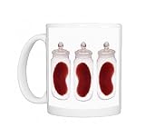 Spare kidneys Photo Mugs
