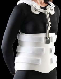 Rigid Modular Spinal System: Stock 4 Panel With SPX (Sternal Pad Kit with Extension Adjustment),, T