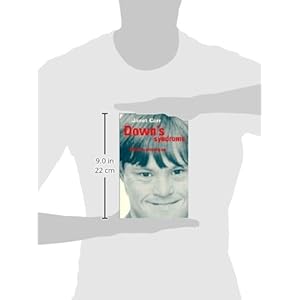 Down's Syndrome: Children Growing Up