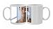 Cosmetic surgery Photo Mugs