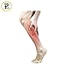 NEW Open Toe Knee Length Zipper Up Compression Hosiery Calf Leg Support Stocking (L/XL, Black)
