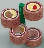 Anatomical Artery Cholesterol Atherosclerosis - Progressively Clogged