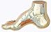 Hollow Foot Model (Pes Cavus)