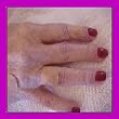 DOT MEDICAL MAGNETS for MAGNETIC THERAPY