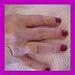   - POWER DOTTM MEDICAL MAGNETS
