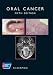Oral Cancer (American Cancer Society Atlas of Clinical Oncology)