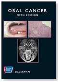Oral Cancer (American Cancer Society Atlas of Clinical Oncology)