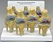   - 4-Stage Osteoarthritis Knee Model